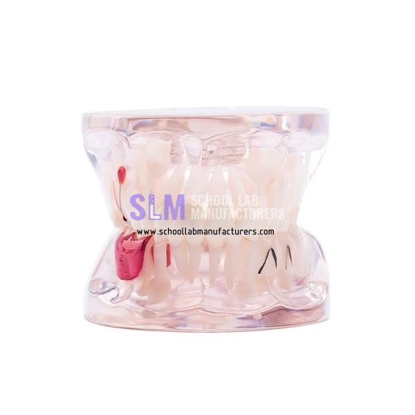 School Lab Dental Teeth Pathology Study Model