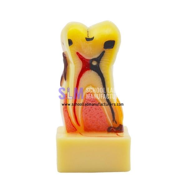 School Lab Disease Teeth Model