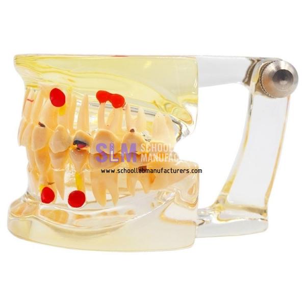 School Lab Oral Clinic Transparent Adult Teeth Model