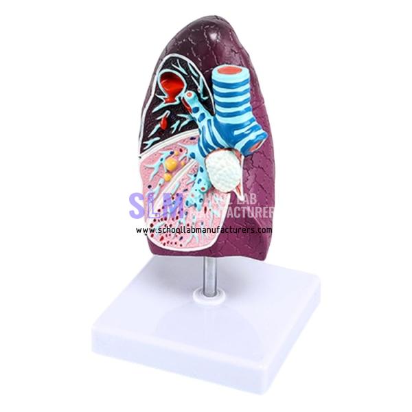 School Lab Pathological Lung Model