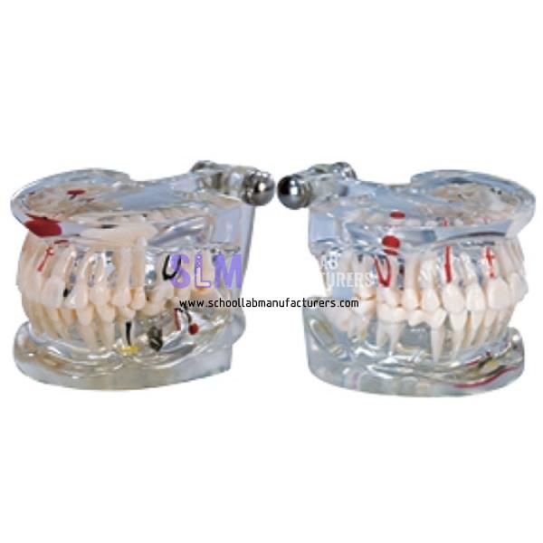 School Lab Pathology Teeth Model