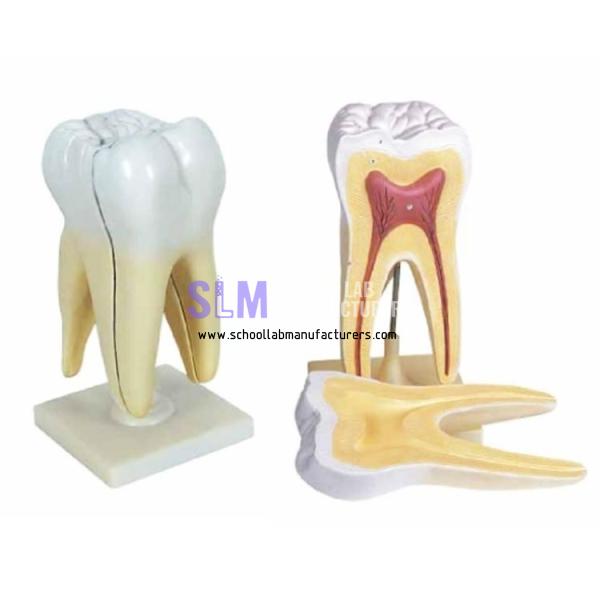 School Lab Triple Root Molar With Caries Model